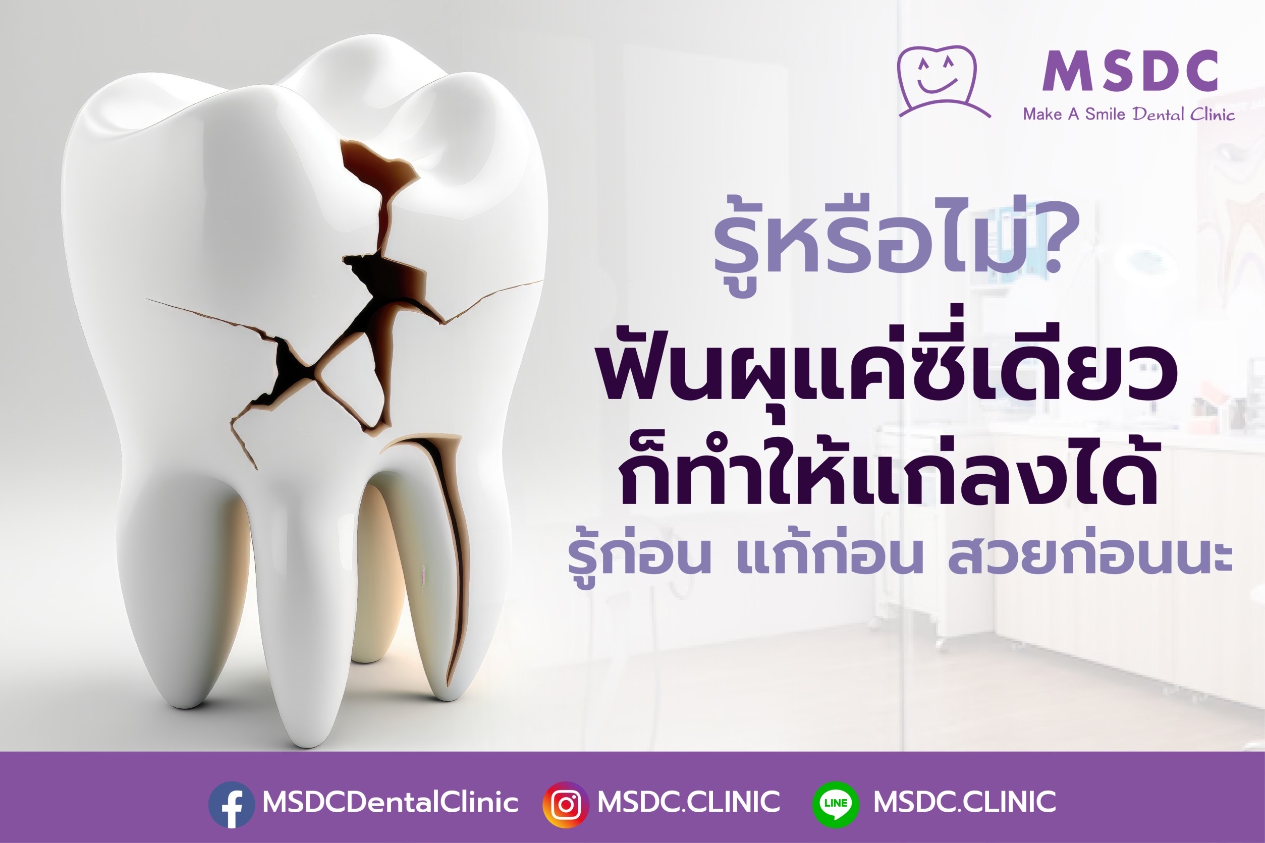 รู้หรือไม่ฟันผุแค่ซี่เดียวทำให้แก่ลงได้