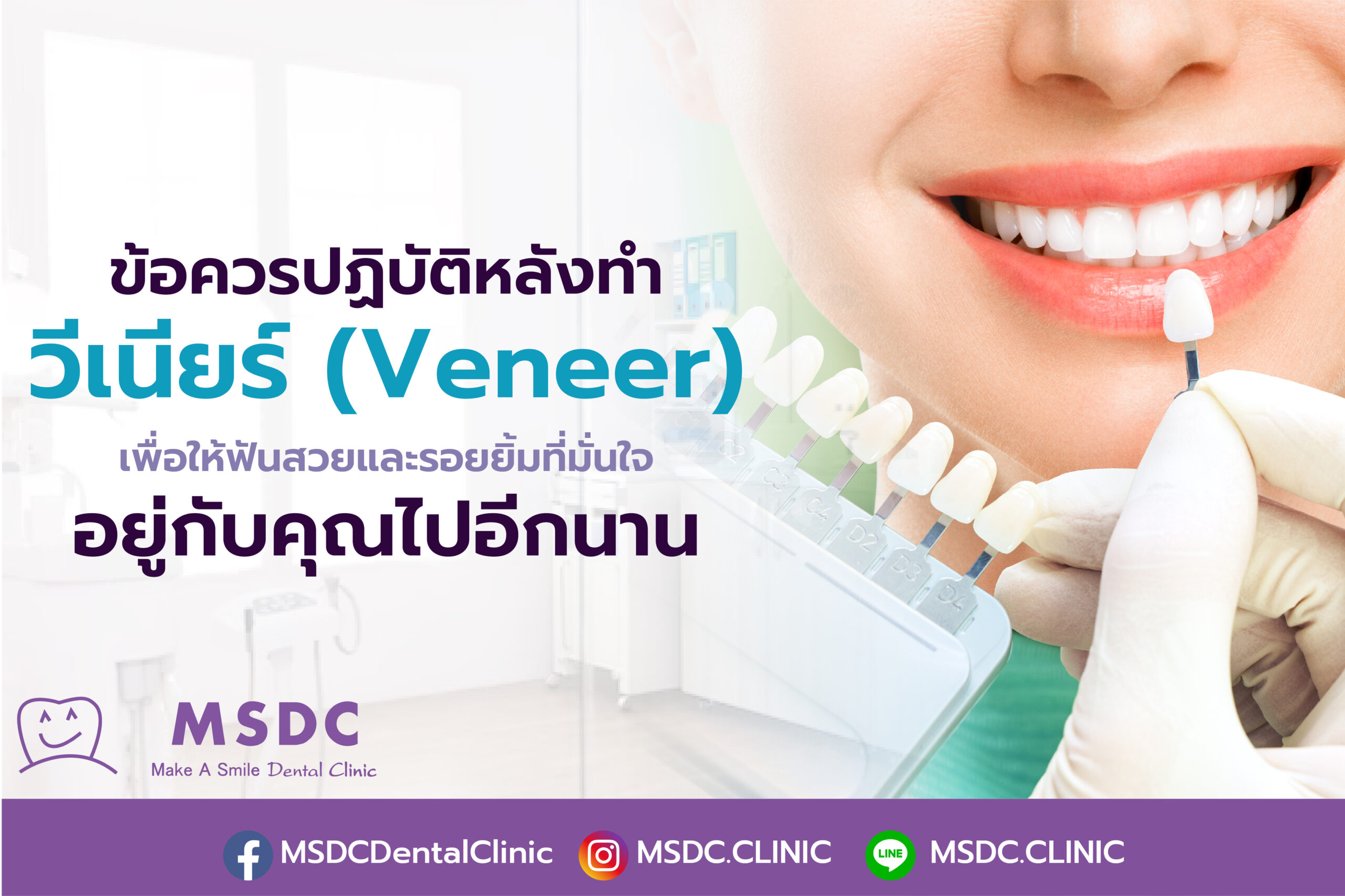 ข้อควรปฏิบัติหลังทำ วีเนียร์ ( Veneer )