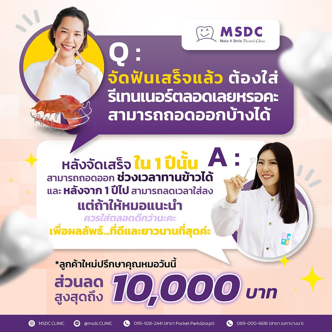 จัดฟันเสร็จแล้ว ต้องใส่รีเทนเนอร์ตลอดเลยหรอคะ